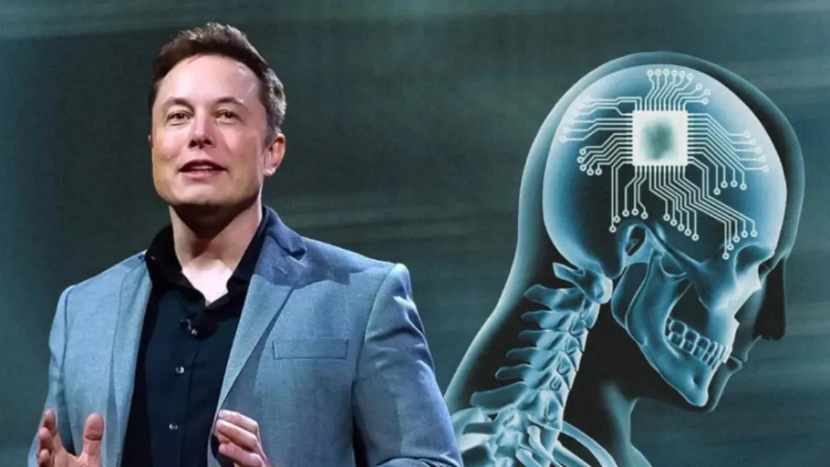 Elon Musk anunció que Neuralink realizó el primer implante cerebral en un ser humano