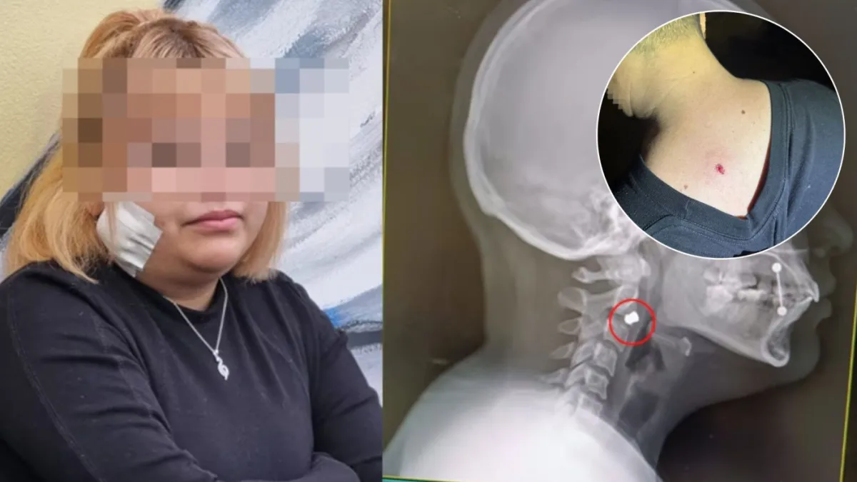Agravan la acusación contra los jóvenes que dispararon en Plaza España
